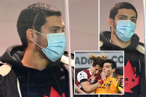 Raul Jimenez shows off shocking head scar in Wolves stands vs Everton after undergoing surgery ...