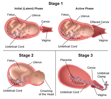 Labor Induction — Denver Holistic Medicine