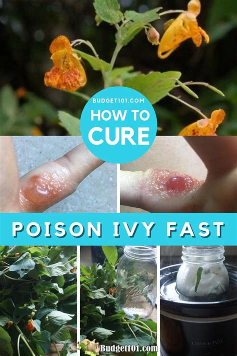 Overnight Poison Ivy Remedy - by Budget101.com™ | Poison ivy remedies, Poison ivy cure, Poison ...