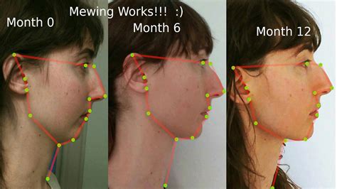 Mewing: The TikTok trend that helps you improve your jawline | tsbnews.com