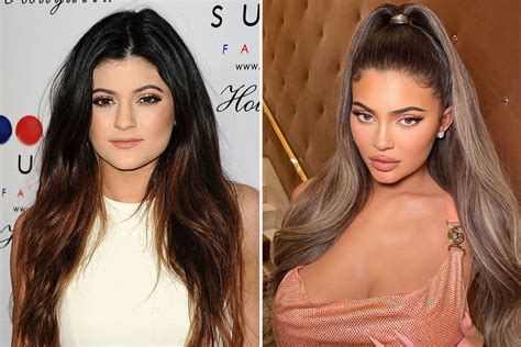 What did Kylie Jenner look like before and after lip filler? | The US Sun