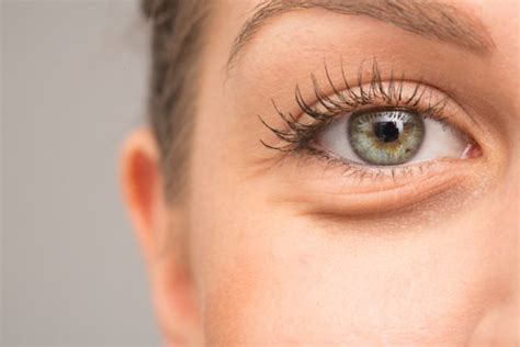 How to Reduce Under-Eye Bags | Harley Street MD