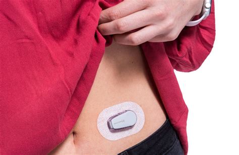 Dexcom G6 Continuous Glucose Monitoring is Now Fully Subsidised - AMSL Diabetes