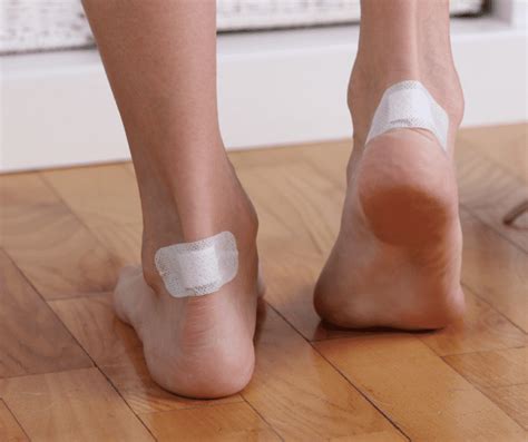 Blisters From Running: How to Treat & Prevent Blisters