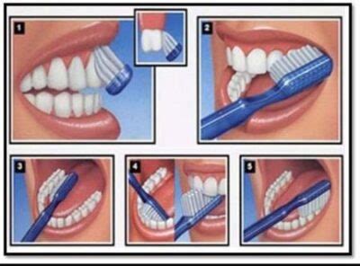 Jak prawidłowo szczotkować zęby? - PrussDent - Klinika Stomatologiczna