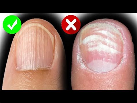 Share more than 147 horizontal lines on nails super hot - cic32.com.vn