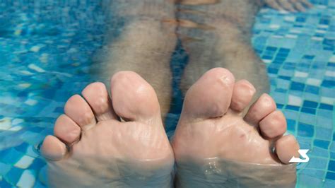 What is swimmers’ toe and what can I do about it? - Relieve Foot Pain & Leg Pain