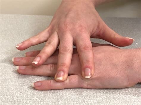 Hand Therapy - Exercises following Dupuytren's Fasciectomy - North Tees and Hartlepool NHS ...