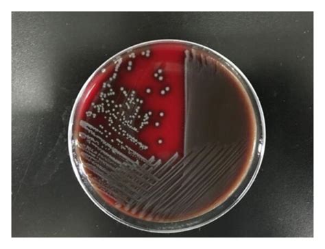 (a) The patient’s blood culture was reported as positive for both ...