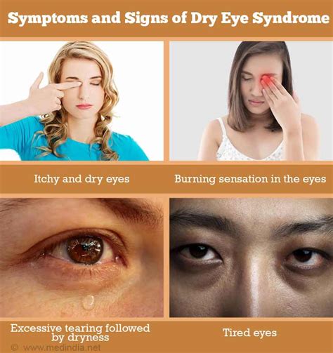 Dry Eye Syndrome Causes Symptoms Of Chronic Dry Eye