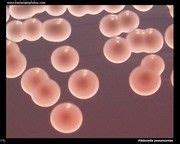 klebsiella pneumoniae Urinary Tract Infection, Infections, Microscopic Cells, Medical Laboratory ...