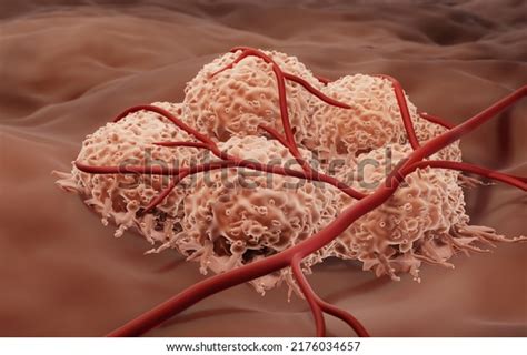 108 Angiogenesis Inhibitor Images, Stock Photos, 3D objects, & Vectors | Shutterstock