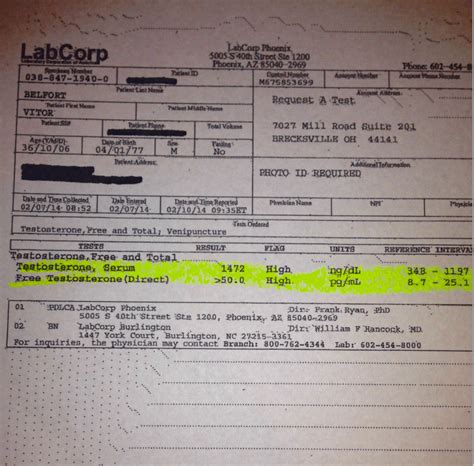 LabCorp Drug Testing Procedures Explained & And How To Pass - Theihcc.com