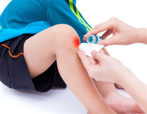 Treating scrapes & grazes | Family Health | Kidspot NZ