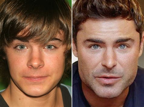 Zac Efron Before and After: From 2004 to 2022 - The Skincare Edit