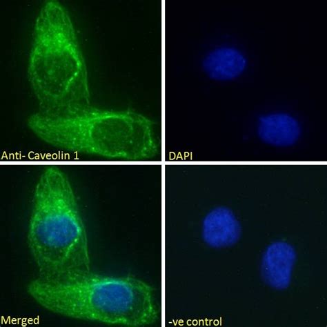 Anti-Caveolin-1 antibody (ab36152) | Abcam