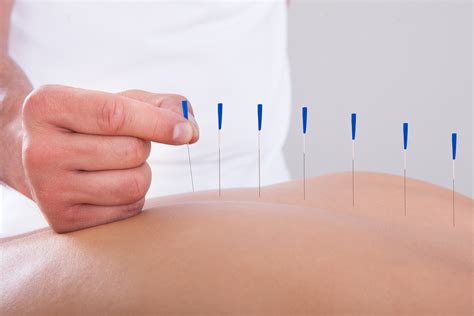 Acupuncture for Hip Pain & Back Pain Treatment - Know About Acupuncture ...