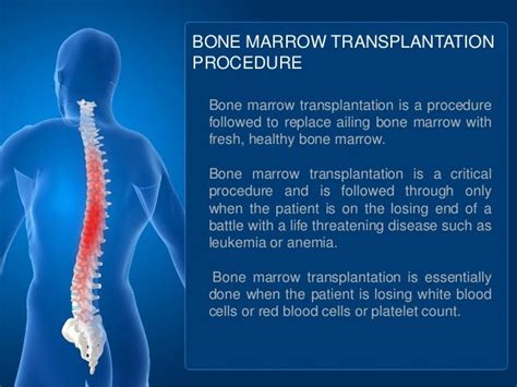 Bone marrow transplantation procedure