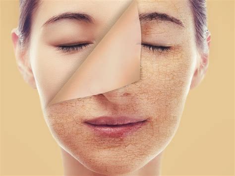 What Causes Skin Dryness? - Meliflua