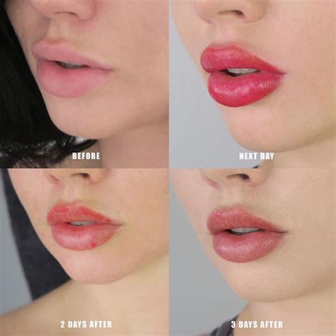 How Long Does Lip Blush Take To Heal? - GA Fashion