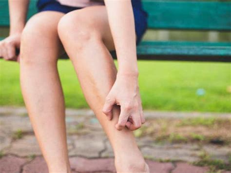 Chapped Skin On Legs Online | bellvalefarms.com