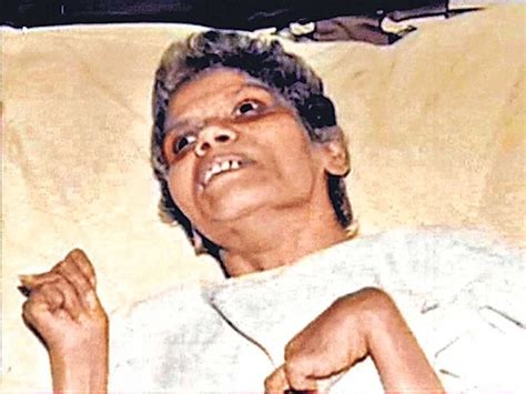 Aruna Shanbaug, The Rape ‘Survivor’ In Coma For 42 Years, On Ventilator ...