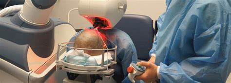 Robotic Hair Transplants: What to Expect | Hair Transplant Dubai