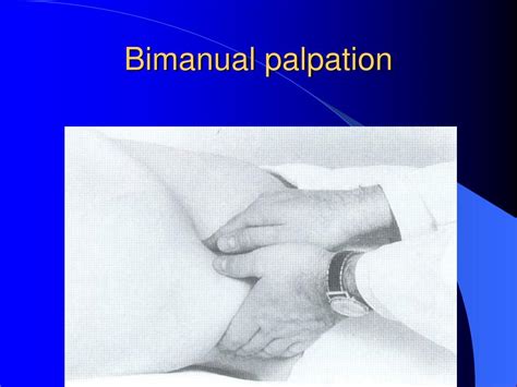 PPT - Physical examination PowerPoint Presentation, free download - ID:1292226