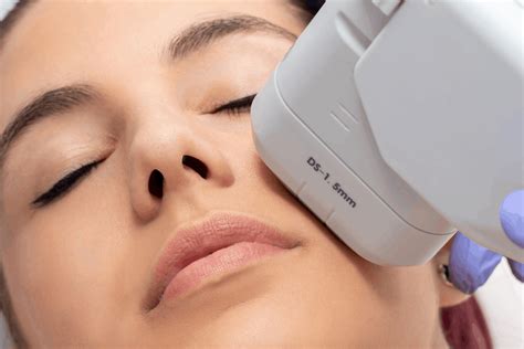 HIFU Facial for Non-invasive Facelift.