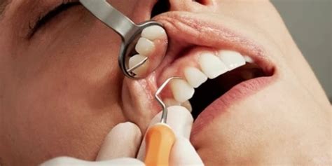 Dental Education In India Faces Decline In Demand Amid Vacant BDS, MDS Seats | DentalReach ...