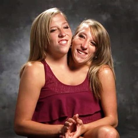 Abby and brittany hensel conjoined twins engaged - pnafile