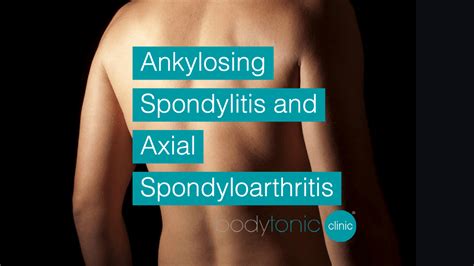 What are Ankylosing Spondylitis and Axial Spondyloarthritis symptoms