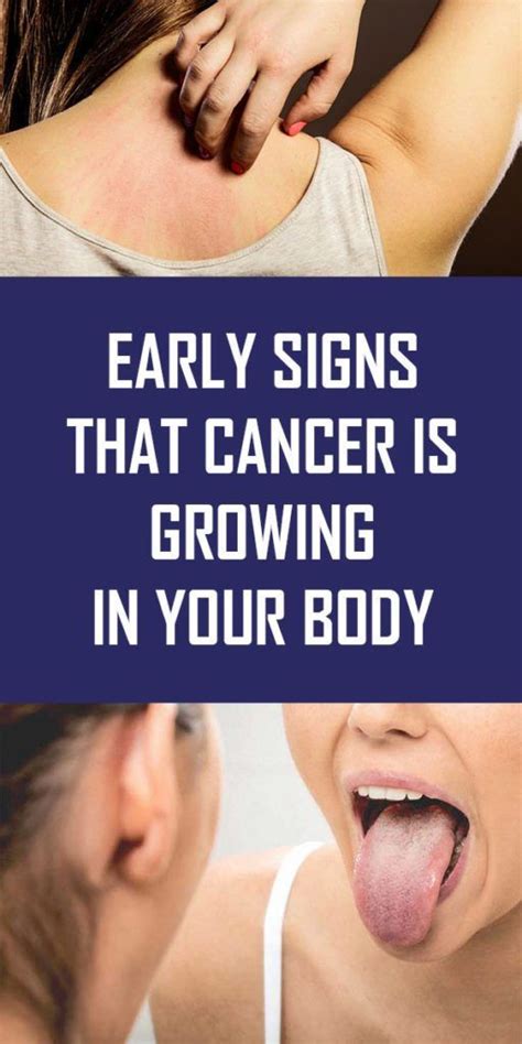 Early Signs That Cancer Is Growing In Your Body