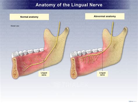 Anatomy of the Lingual Nerve - TrialExhibits Inc.