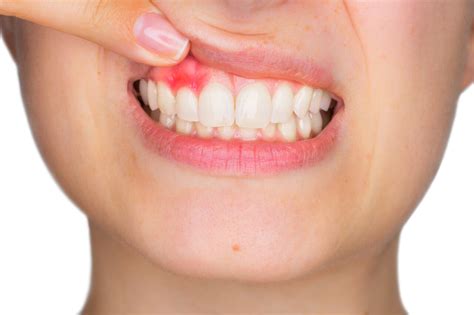 Tooth Abscess and Jaw Bone Infection: What You Need to Know