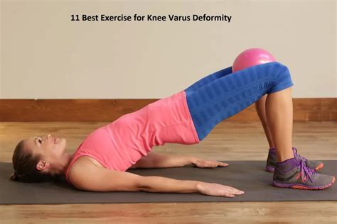 Strengthening exercises for knee varus Archives - Samarpan ...