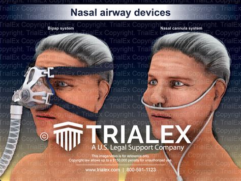 Nasal Airway Devices - TrialExhibits Inc.