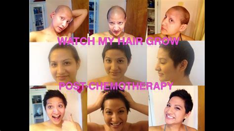 Chemotherapy Hair Loss Timeline pertaining to Encourage