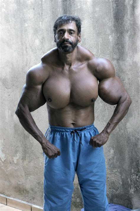 Synthol Side Effects