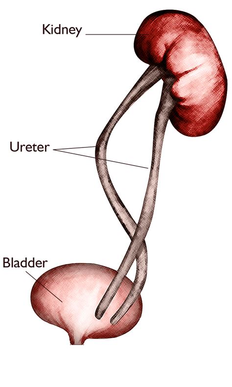 Duplicated Right Renal Collecting System - hideawaytips