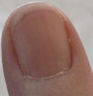 Pin on Fingernails