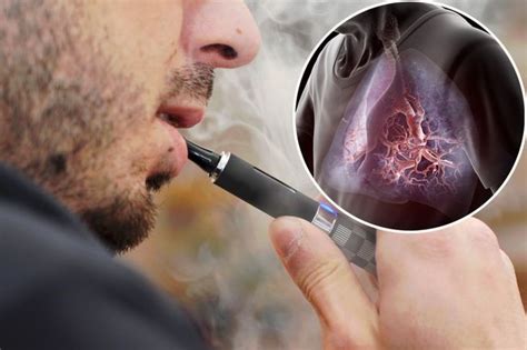 Will chronic e-cigarette use cause lung disease? - Thoracic and Sleep Group Queensland