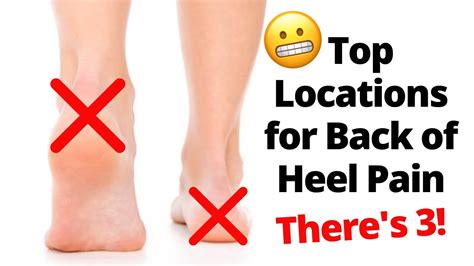 Back of The Heel Pain: Locations - YouTube