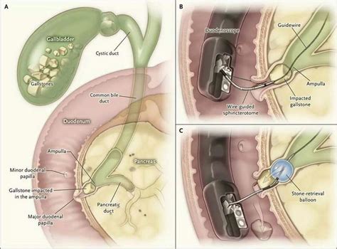 Pin by Harold Siquian on Medicine_Gastro | Medical anatomy, Medical knowledge, Medical