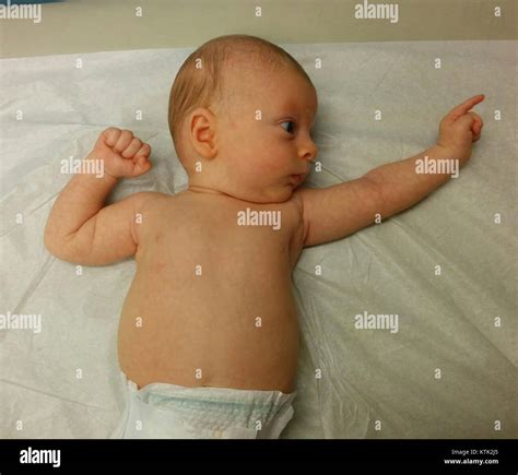 Asymmetrical tonic neck reflex (ATNR) at Two Months Stock Photo - Alamy