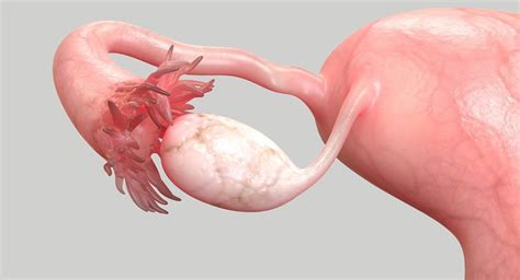 What is Fallopian Tube Cancer? Symptoms, Risk Factors & Treatments | MD Anderson Cancer Center