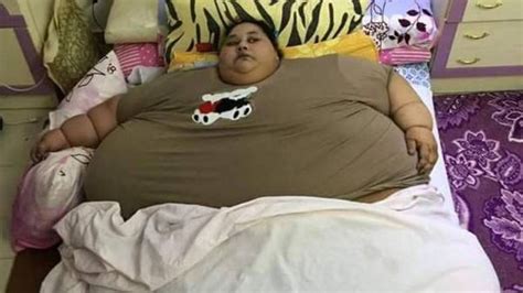 World’s Fattest Woman To Undergo Surgery in India