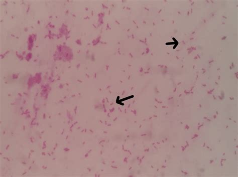 Gram Negative Bacilli Were Seen In The Gram Stain Wit - vrogue.co