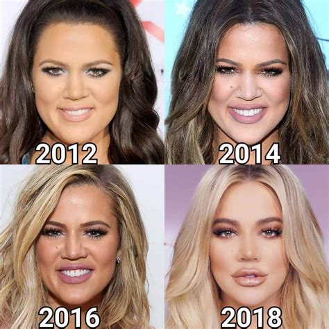 Khloe Kardashian: 2012-2018 Yılları Arası Değişimi #beforeafter # ...