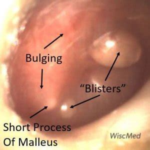 Clinical Ear Anatomy Case and Image Library - WiscMed